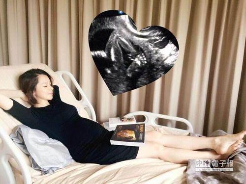 徐若瑄晒B超照称胎儿健康 医生仍担忧其早产