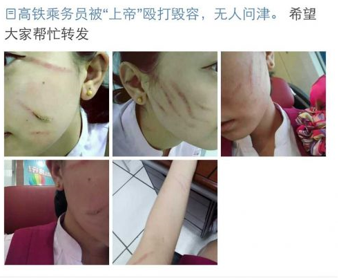 高铁乘务员被12名乘客殴打 脸和胳膊有多处伤口