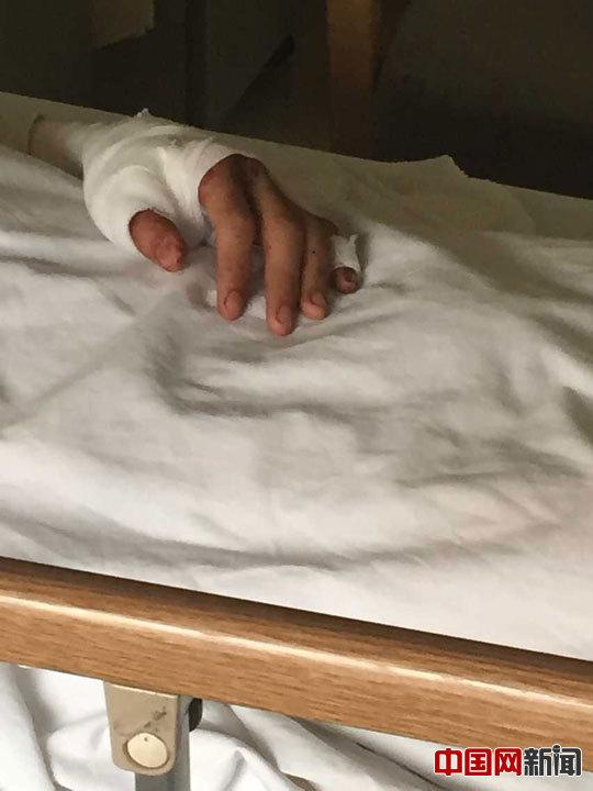 天津90后男孩爆炸中救室友 身缝近40余针(图)