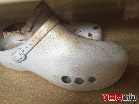 天津90后男孩爆炸中救室友 身缝近40余针(图)