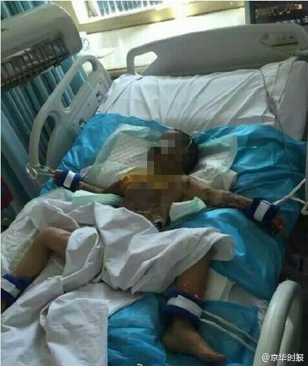 湖南两兄妹被同村老人灌浓硫酸 5岁女童死亡