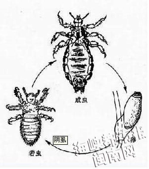 女童眼睫毛长20只阴虱 医生：不注重卫生所致