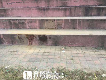 轿车在操场飙车撞上女生致其截肢 司机被控制