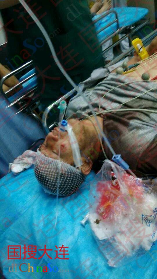 16个月大婴儿被货车碾过 肇事司机逃逸拒不认罪