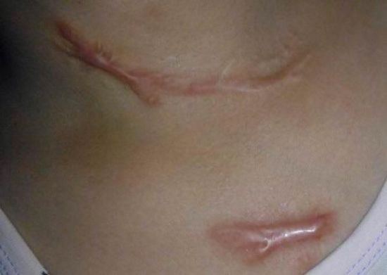 法医鉴定报告显示，黄晓芹胸口、颈部、左右臂以及左中指都有长2厘米至16厘米的不规则伤口，已构成轻伤。