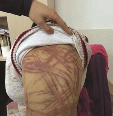 南京浦口虐童案宣判 被告人李征琴获刑6个月