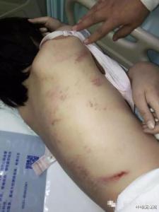 因被疑抢舍友的男朋友 少女被围殴5小时