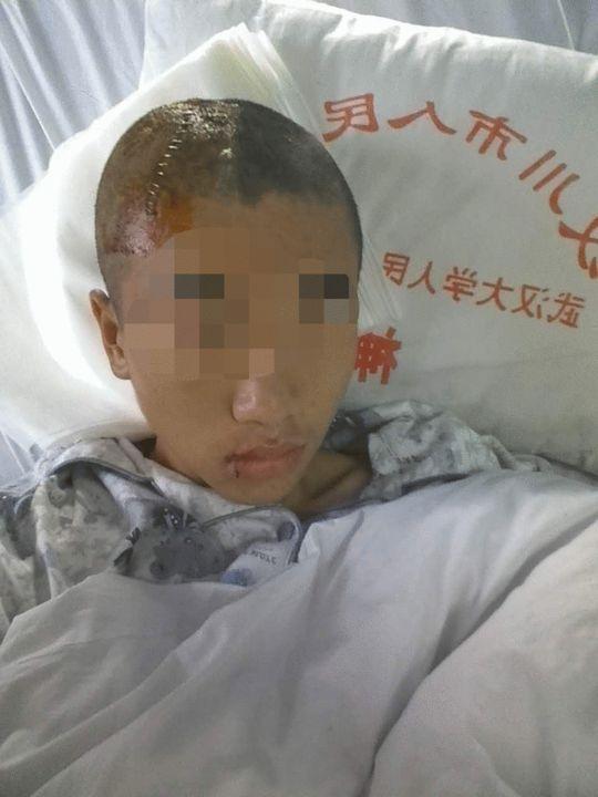 15岁学生参与强拆做打手 头被打骨折无人负责