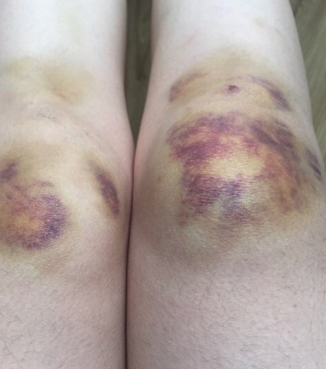 秦皇岛考核办副主任遭免职 曾被曝踹情妇致绝育