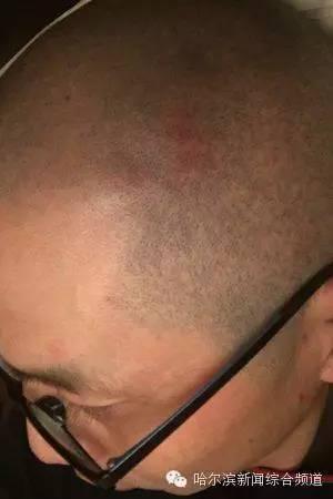 哈尔滨万元吃鱼：剧情大逆转了？真相究竟是什么？ 