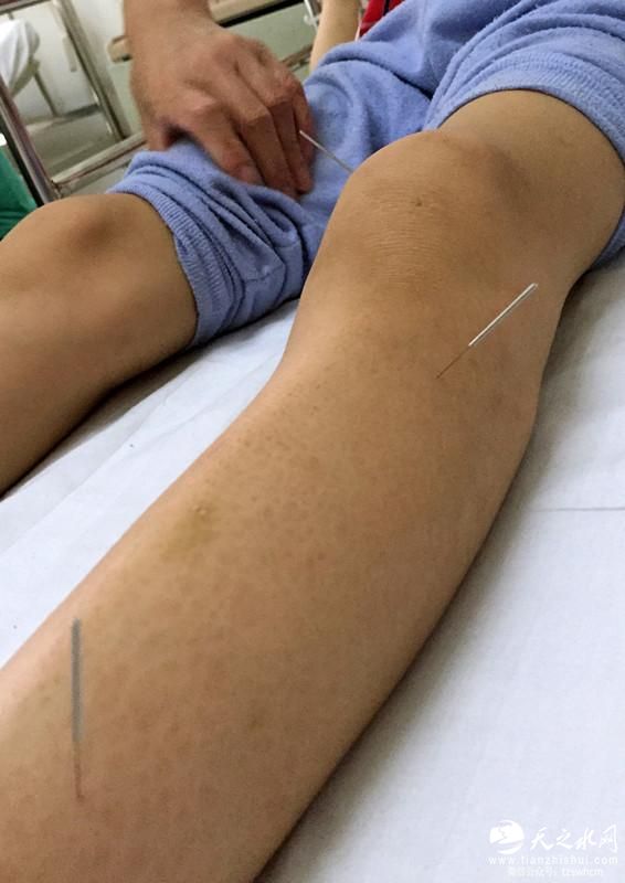 男孩被送殡仪馆发现未死 已能说能吃能动(图)