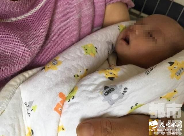 女子产下罕见胎中胎 男婴腹中“怀”胎儿