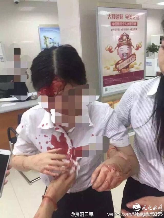 贵州一银行女柜员头被客户砸破 柜员群体不容易