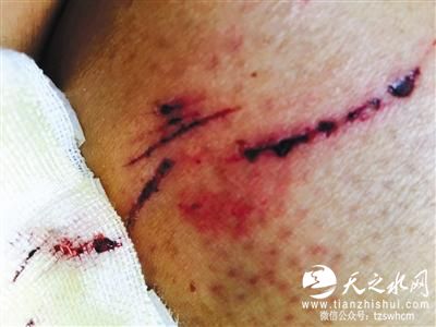 北京清河恶犬出没咬伤12人 40余人搜捕仍未果