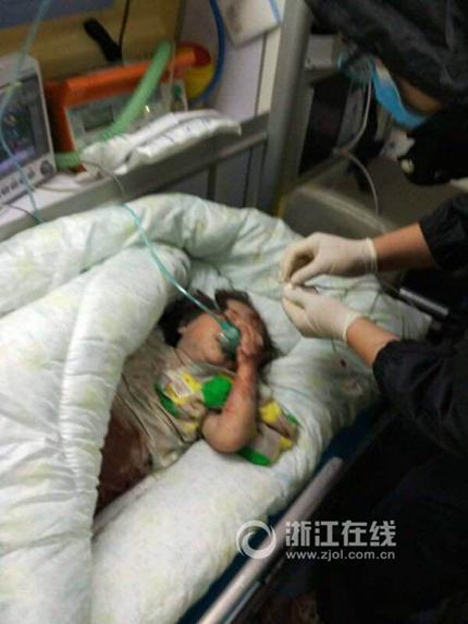 小女孩在医院接受治疗。