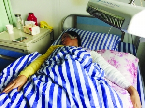 吴女士全身14%面积被烫伤