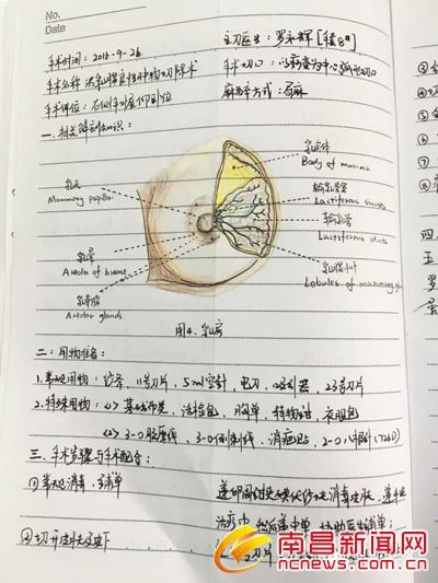 90后美女护士手术笔记走红 字迹工整解剖图手绘