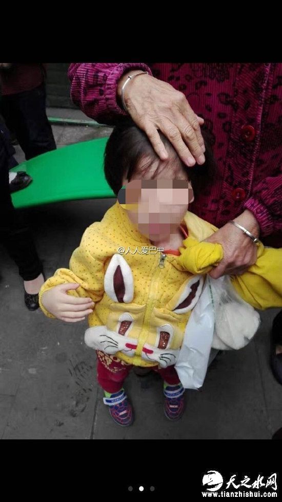 女童的头部有伤痕。 来源：@人人爱巴中