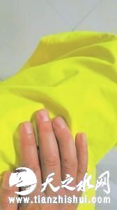 受伤民警无名指明显变形。